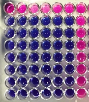 Jundishapur J Microbiol